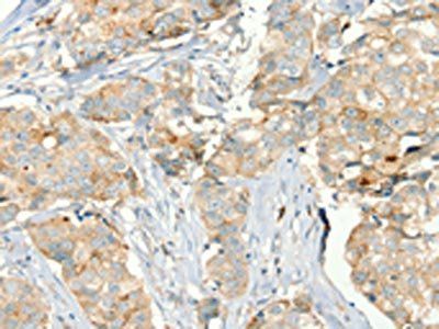 MMP9 Antibody