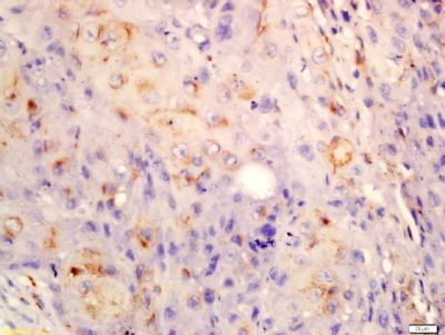 MMP9 Rabbit Polyclonal Antibody