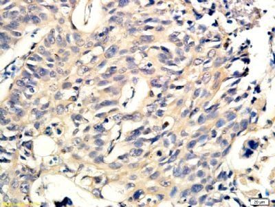 MMP9 Rabbit Polyclonal Antibody