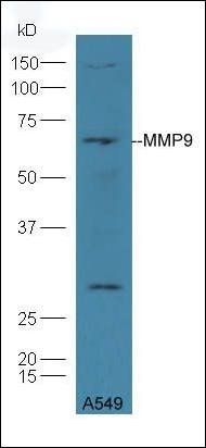 MMP9 Rabbit Polyclonal Antibody