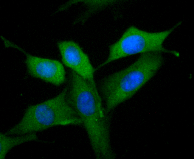 MMP9 Antibody