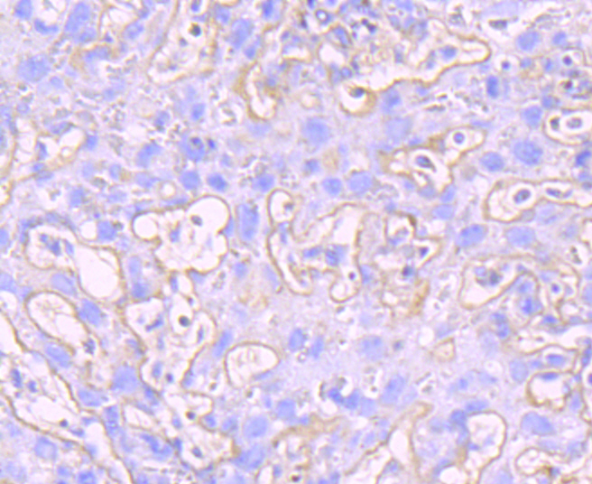 MMP9 Antibody