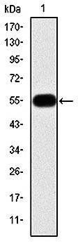 MMP9 Antibody