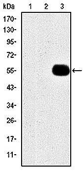 MMP9 Antibody