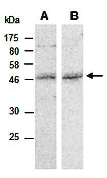 MMS21 (N) Antibody, Rabbit Polyclonal