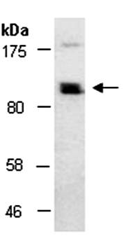 MOCOS (N) Antibody, Rabbit Polyclonal