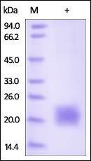 Cynomolgus / Rhesus macaque CTLA-4 Protein, His Tag