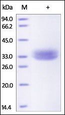 Rhesus macaque EpCAM Protein, His Tag