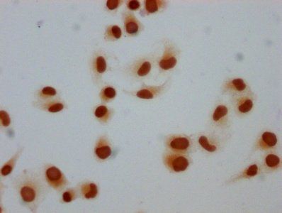 H1F0 Antibody