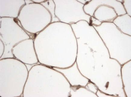 Rabbit anti Human Monoglyceride lipase Antibody