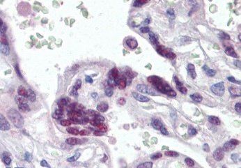MRG15/MORF4L1 Antibody