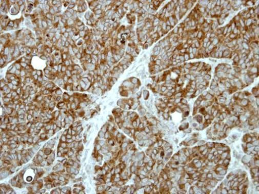 MP1 Rabbit Polyclonal Antibody