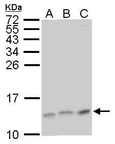 MP1 Rabbit Polyclonal Antibody