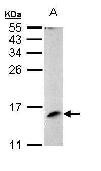 MP1 Rabbit Polyclonal Antibody