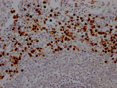 MPO Antibody