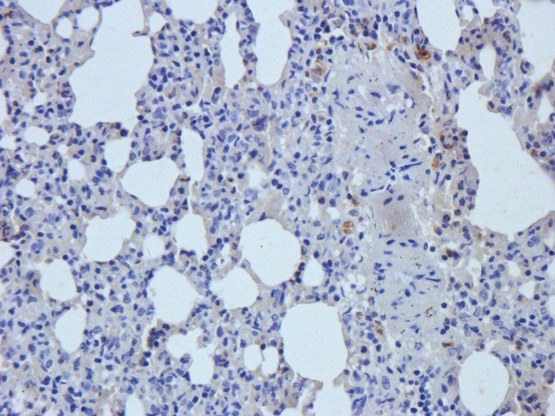 Myeloperoxidase Rabbit Polyclonal Antibody