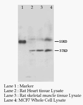 MRGX1/MRGPRX1 Rabbit Polyclonal Antibody