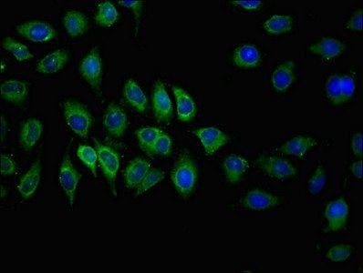ABCC2 Antibody