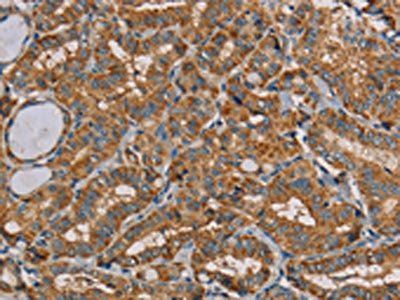 MRPL11 Antibody