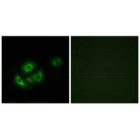 MRPL11 Antibody