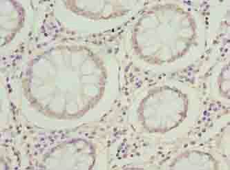 MRPL14 Antibody