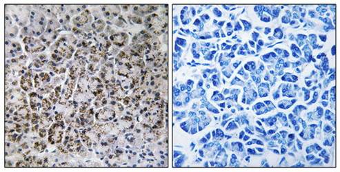 MRPL40 Antibody