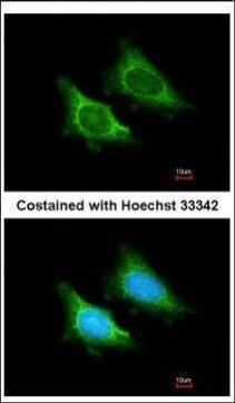 mitochondrial ribosomal protein S5 Antibody