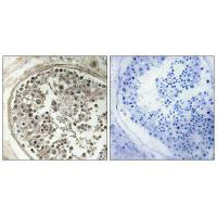 MRPS5 Antibody