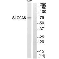 SLC9A6 Antibody