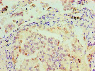 MSH6 Antibody
