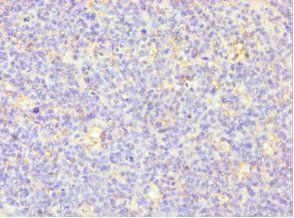 MSLN Antibody