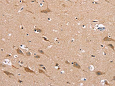 MSMB Antibody