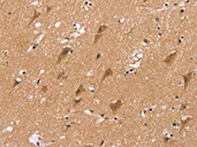 MSMB Antibody
