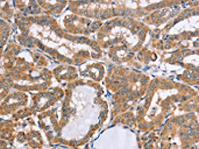 MSMB Antibody