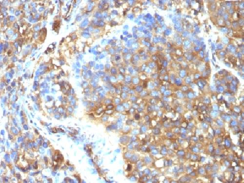 MSN Antibody