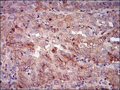 Bpifa2 Antibody