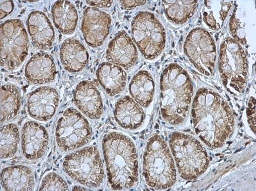 MST4 antibody [N2C3]