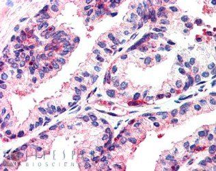 MSX1 Antibody