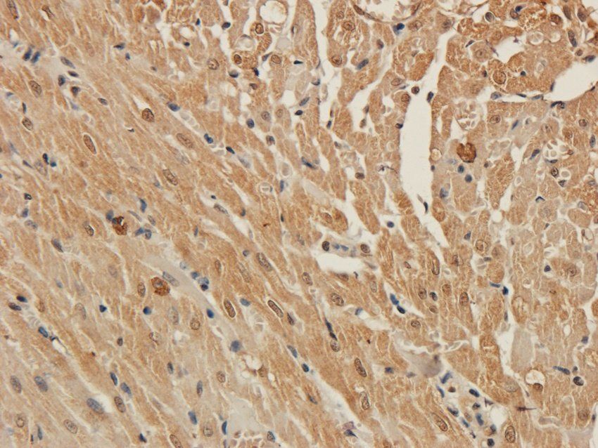 MT-ATP8 Rabbit Polyclonal Antibody