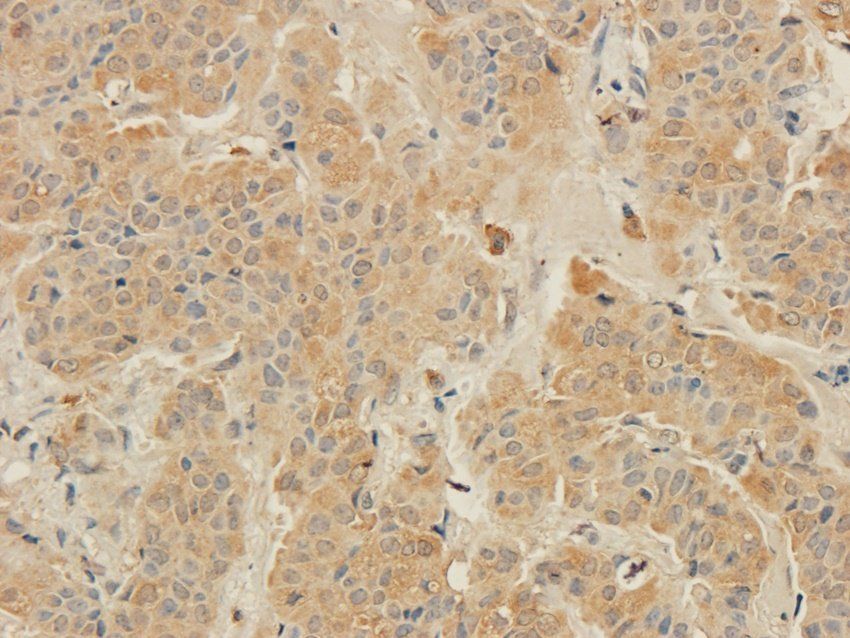 MT-ATP8 Rabbit Polyclonal Antibody