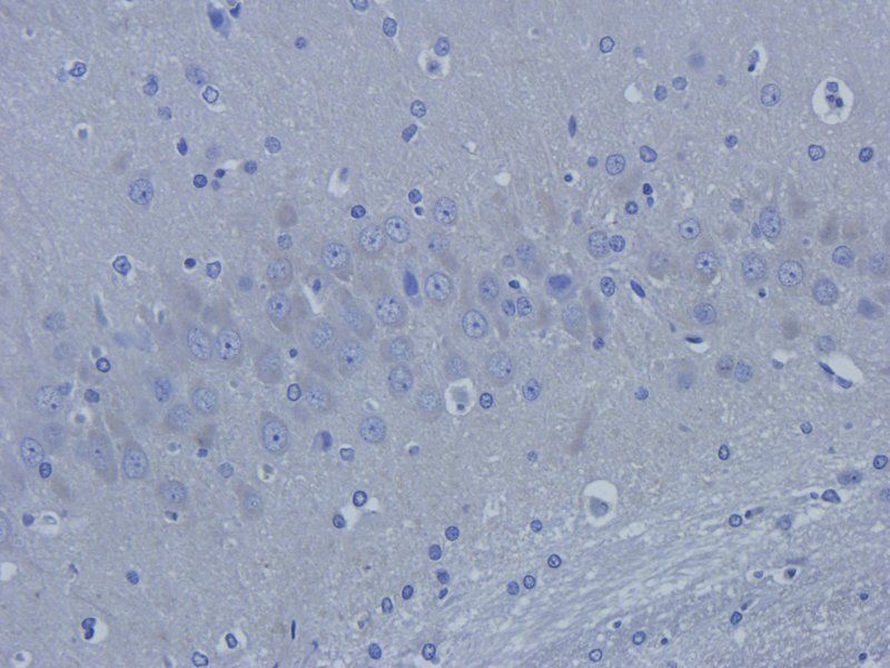 MT-ATP8 Rabbit Polyclonal Antibody