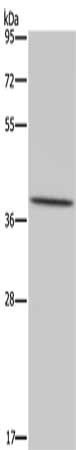 MT-ND1 Antibody