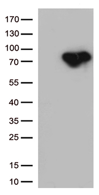 MTHFR Antibody