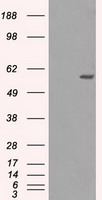 MTHFR Antibody