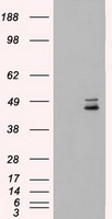 MTHFR Antibody