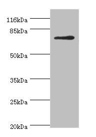MTHFR Antibody