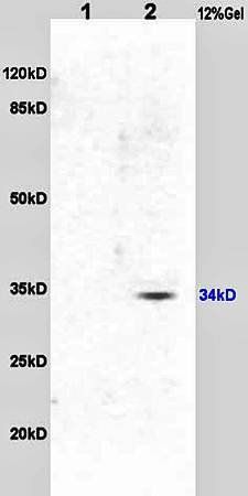 MTHFR Rabbit Polyclonal Antibody