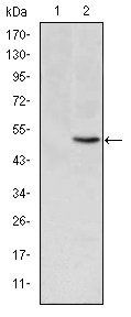 MTHFR Antibody