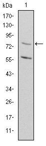 MTHFR Antibody
