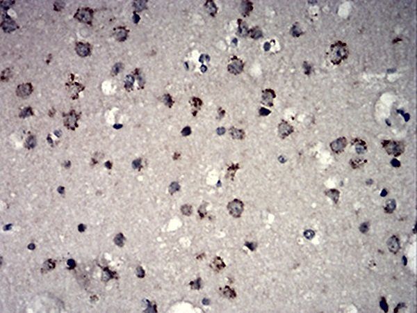 mTOR Antibody